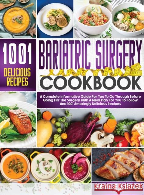 Bariatric Surgery Cookbook: A Complete Informative Guide for You to Go Through Before Going for the Surgery With a Meal Plan For You to Follow and Faye Elledge 9781915078247 Faye Elledge