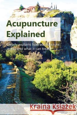 Acupuncture Explained: Clearly explains how acupuncture works and what it can treat Kovich, Fletcher 9781916483002