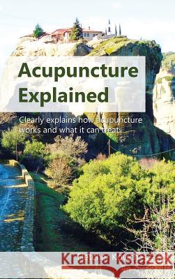 Acupuncture Explained: Clearly explains how acupuncture works and what it can treat Kovich, Fletcher 9781916483026 CuriousPages Publishing