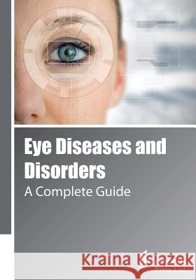 Eye Diseases and Disorders: A Complete Guide Iconcept Press 9781922227324 Iconcept Press