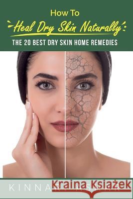 How to Heal Dry Skin Naturally: The 20 Best Dry Skin Home Remedies Kinnari Ashar Neil Germio 9781922649805 SF Nonfiction Books