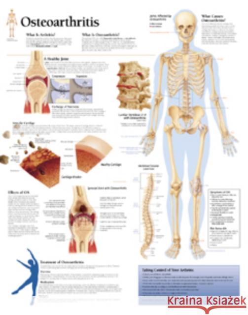 Osteoarthritis Laminated Poster Scientific Publishing 9781930633155 Scientific Publishing Limited