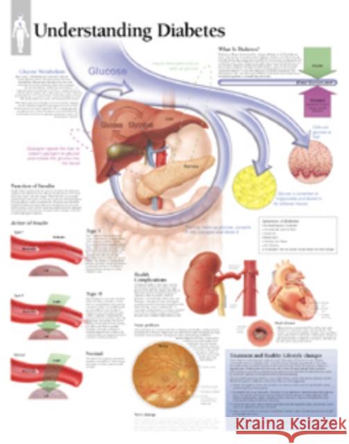 Understanding Diabetes Paper Poster Scientific Publishing 9781930633285 Scientific Publishing Limited