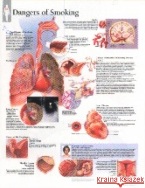 Effects of Smoking Laminated Poster Scientific Publishing 9781930633377 Scientific Publishing Limited