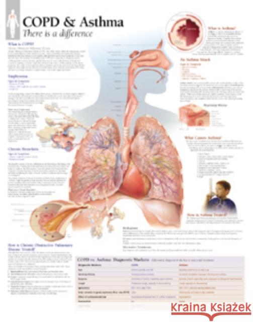 COPD & Asthma Paper Poster Scientific Publishing 9781930633445 Scientific Publishing Limited