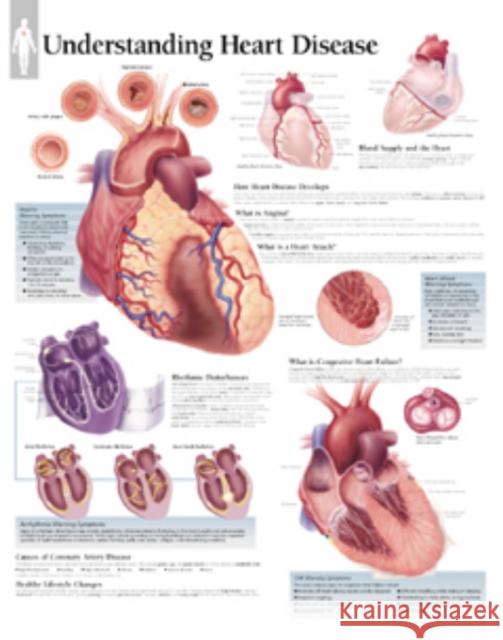 Understanding Heart Disease Paper Poster Scientific Publishing 9781930633469 SCIENTIFIC PUBLISHING