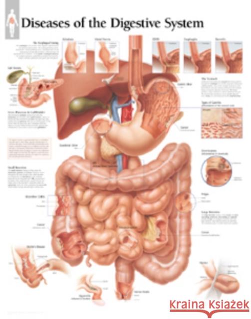 Diseases of the Digestive System Laminated Poster Scientific Publishing 9781930633537 SCIENTIFIC PUBLISHING