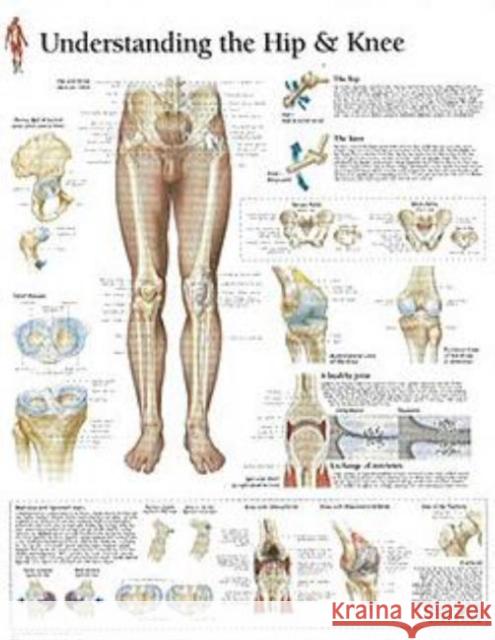 Understanding the Hip & Knee Paper Poster Scientific Publishing 9781930633681 Scientific Publishing Limited