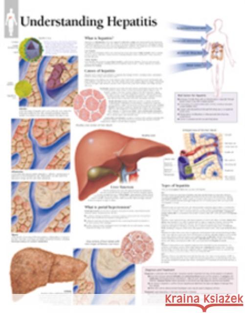 Understanding Hepatitis Paper Poster Scientific Publishing 9781930633841 Scientific Publishing Limited