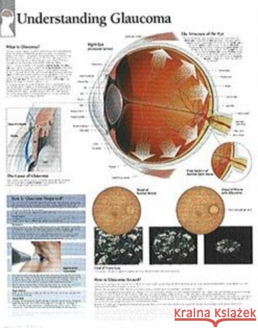 Understanding Glaucoma Paper Poster Scientific Publishing 9781930633865 Scientific Publishing Limited