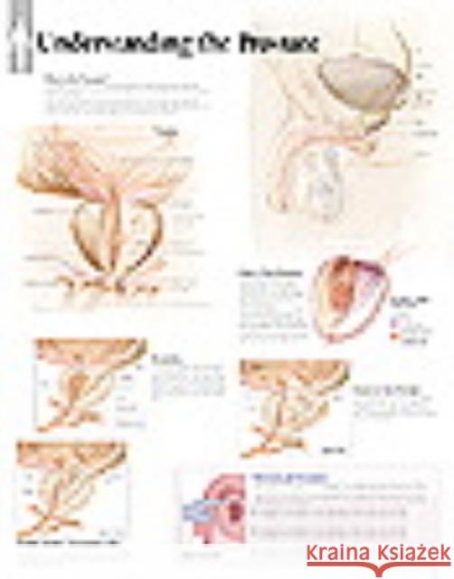 Understanding the Prostate Laminated Poster Scientific Publishing 9781930633995 Scientific Publishing Limited