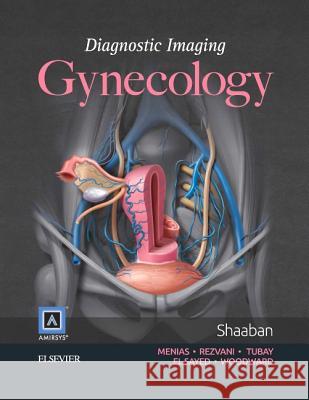 Gynecology Akram A. Shaaban 9781931884778 Amirsys