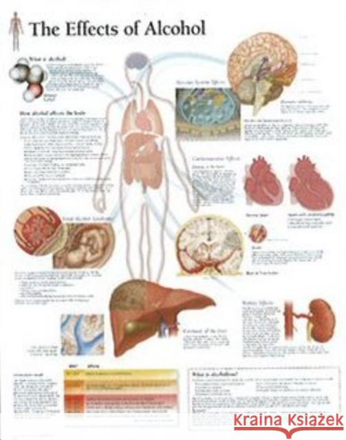 Effects of Alcohol Laminated Poster  9781932922028 SCIENTIFIC PUBLISHING