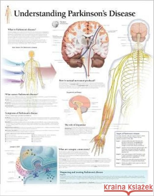 Understanding Parkinson's Laminated Poster Scientific Publishing 9781932922127 Scientific Publishing