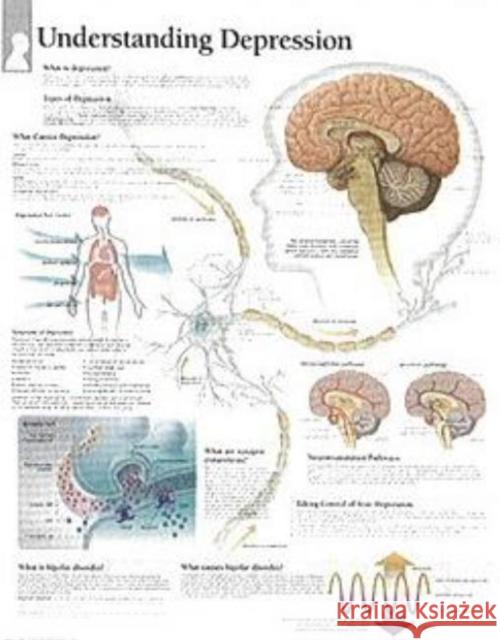 Understanding Depression Laminated Poster Scientific Publishing 9781932922165 Scientific Publishing