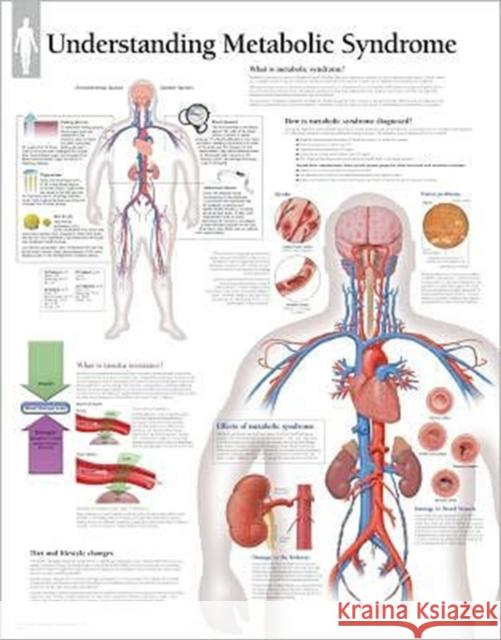 Understanding Metabolic Syndrome Laminated Poster Scientific Publishing 9781932922264 Scientific Publishing