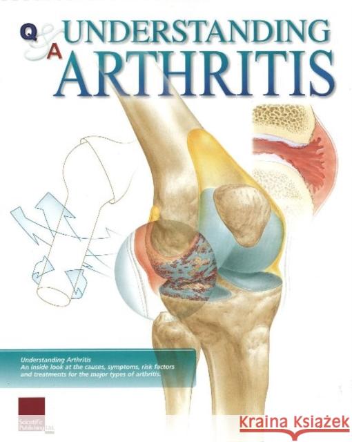 Understanding Arthritis Flip Chart Scientific Publishing 9781932922288 Scientific Publishing
