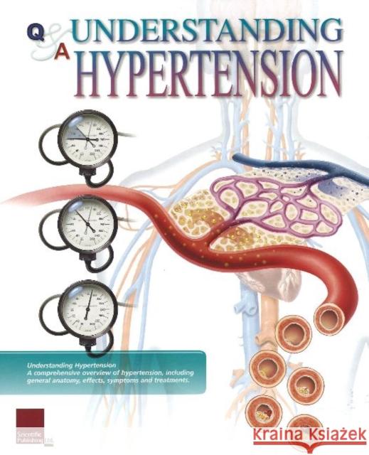 Understanding Hypertension Flip Chart Scientific Publishing 9781932922301 Scientific Publishing