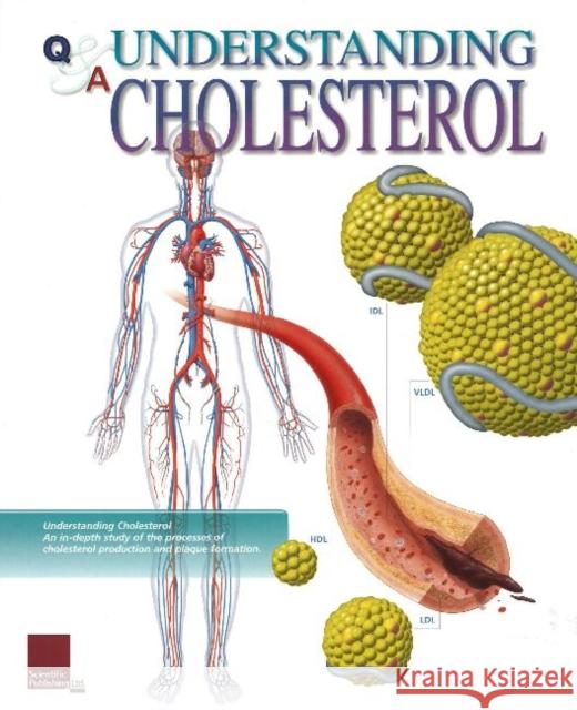 Understanding Cholesterol Flip Chart Scientific Publishing 9781932922332 Scientific Publishing