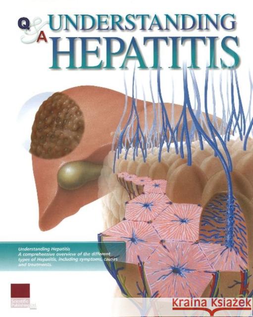 Understanding Hepatitis Flip Chart Scientific Publishing 9781932922349 Scientific Publishing