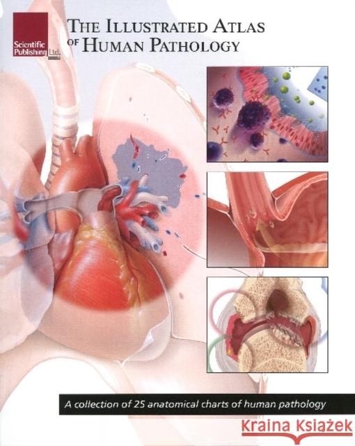 Illustrated Atlas of Human Pathology: A Collection of 25 Anatomical Charts of Human Pathology Scientific Publishing 9781932922998 Scientific Publishing
