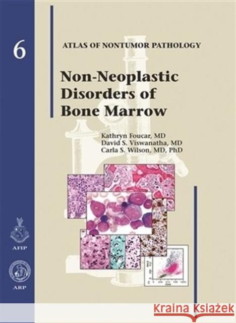 Atlas of Nontumor Pathology: Non-Neoplastic Disorders of Bone Marrow Foucar, Kathryn 9781933477046 American Registry of Pathology