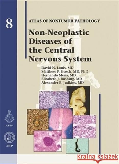 Non-Neoplastic Diseases of the Central Nervous System  9781933477084 American Registry of Pathology