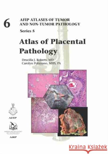 Atlas of Placental Pathology Drucilla J. Roberts Carolyn Polizzano  9781933477091 American Registry of Pathology