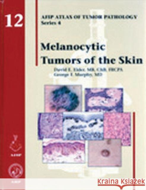 Melanocytic Tumors of the Skin  9781933477107 American Registry of Pathology
