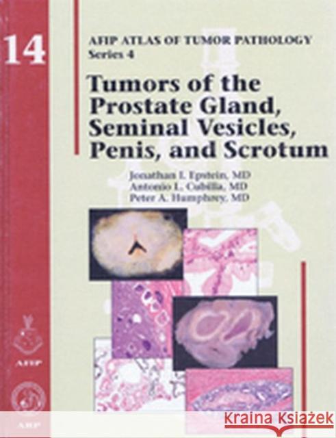 Tumors of the Prostate Gland, Seminal Vesicles, Penis, and Scrotum Jonathan I Epstein Antonio L. Cubilla Peter A. Humphrey 9781933477145