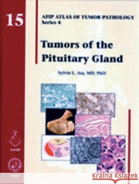 Tumors of the Pituitary Gland  9781933477152 American Registry of Pathology