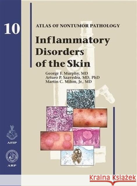 Inflammatory Disorders of the Skin  9781933477244 American Registry of Pathology