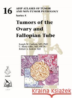 Tumors of the Ovary and Fallopian Tube Joseph W. Carlson, C. Blake Gilks, Robert A. Soslow 9781933477282