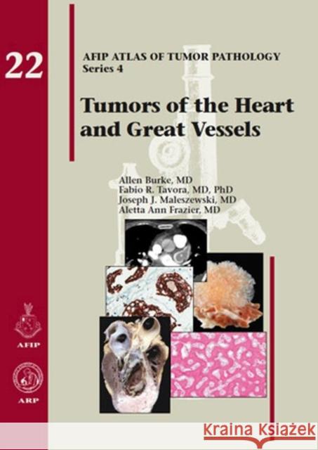 Tumors of the Heart and Great Vessels: 22: Afip Atlas of Tumor Pathology Series 4 Fascicle 22 Allen P. Burke Fabio R. Tavora  9781933477336 American Registry of Pathology