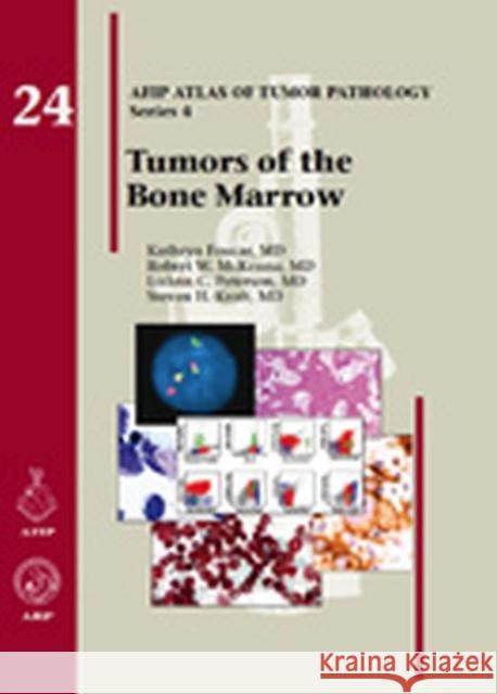 Tumors of the Bone Marrow Kathryn Foucar Robert W. McKenna LoAnn C. Peterson 9781933477350