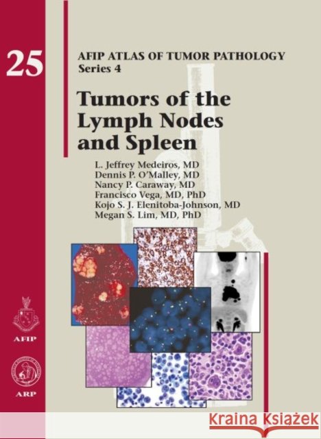 Tumors of the Lymph Node and Spleen  Medeiros, L. Jeffrey|||OOMalley, Dennis P.|||Caraway, Nancy P. 9781933477381