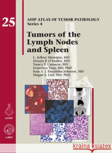 Tumors of the Lymph Node and Spleen  Medeiros, L. Jeffrey|||OOMalley, Dennis P.|||Caraway, Nancy P. 9781933477381 Atlas of Tumor Pathology, Series 4, Number 25