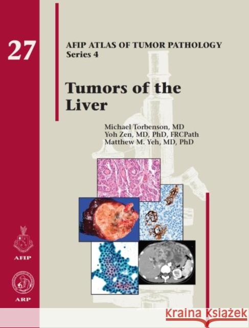 Tumors of the Liver Michael Torbenson, MD Yoh Zeh Matthew M. Yeh 9781933477411 American Registry of Pathology