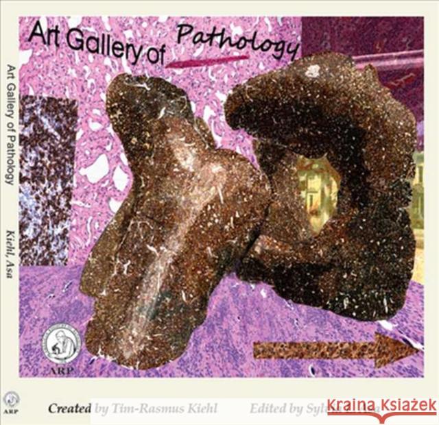 Art Gallery of Pathology Tim-Rasmus Kiehl Sylvia Asa  9781933477459 American Registry of Pathology
