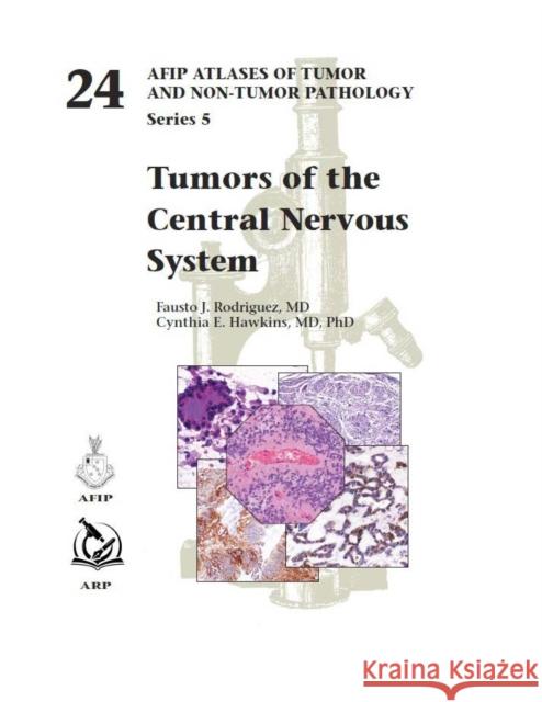 Tumors of the Central Nervous System Cynthia E. Hawkins 9781933477640