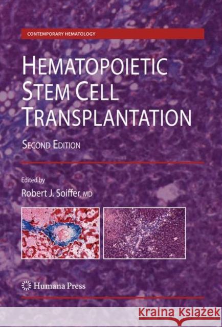 Hematopoietic Stem Cell Transplantation Robert J. Soiffer 9781934115053 Humana Press