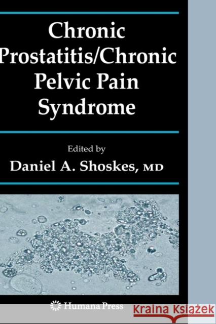 Chronic Prostatitis/Chronic Pelvic Pain Syndrome Daniel A. Shoskes 9781934115275 Not Avail