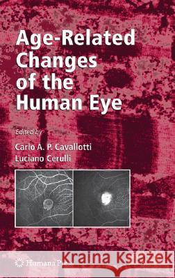 Age-Related Changes of the Human Eye  9781934115558 HUMANA PRESS INC.,U.S.