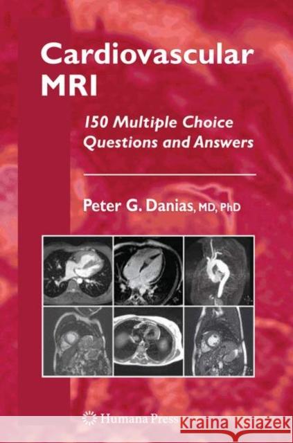 Cardiovascular MRI: 150 Multiple-Choice Questions and Answers Danias, Peter G. 9781934115596 HUMANA PRESS INC.,U.S.