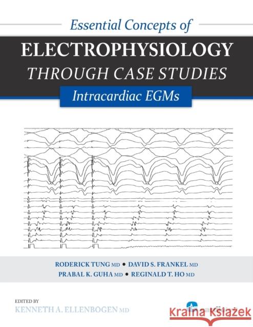 Essential Concepts of Electrophysiology through Case Studies: Intracardiac EGMs Kenneth Ellenbogen Roderick Tung David Frankel 9781935395331 Cardiotext Inc