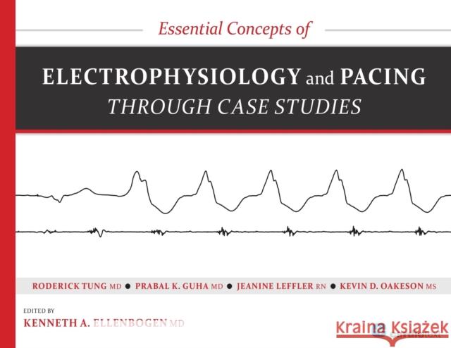 Essential Concepts of Electrophysiology and Pacing through Case Studies Ellenbogen, Kenneth a. 9781935395850 Cardiotext, Inc.