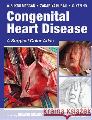 Congenital Heart Disease: A Surgical Color Atlas  9781935395904 