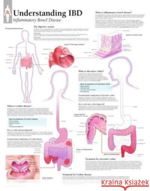 Understanding IBD Scientific Publishing 9781935612773 Scientific Publishing Limited