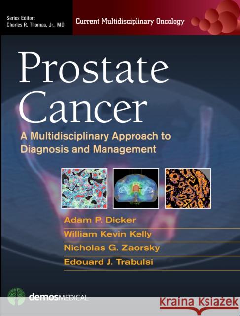 Prostate Cancer: A Multidisciplinary Approach to Diagnosis and Management Adam P. Dicker 9781936287598