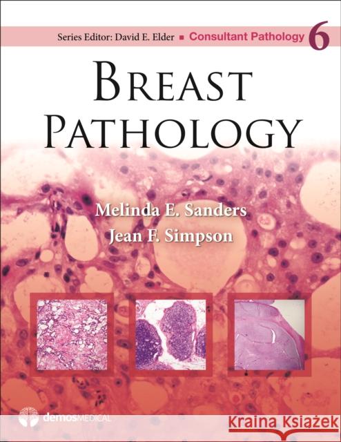 Breast Pathology Melinda E. Sanders Jean Simpson David Elder 9781936287680 Demos Medical Publishing